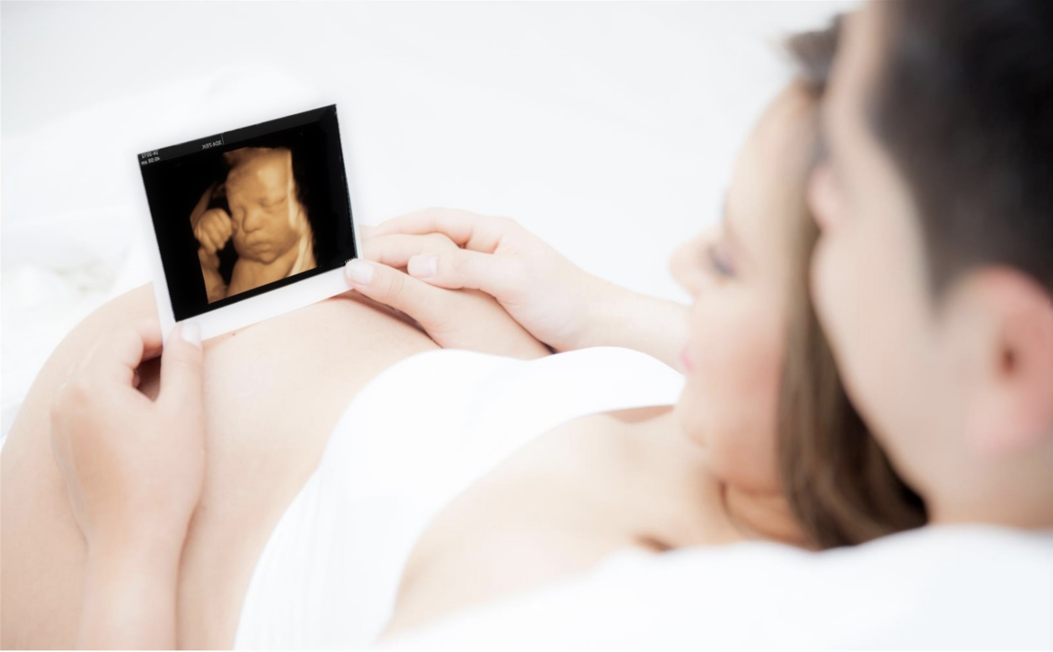 4d ultrasound sarasota FL 3D ultrasound bradenton fl 3D 4D sonogram north port fl 3D 4D ultrasound port charlotte FL