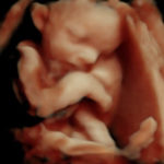 4d ultrasound