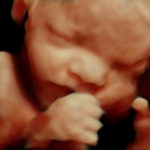 4d ultrasound