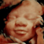 4d ultrasound