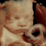 25 week