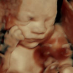 26 weeks