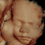 26 weeks