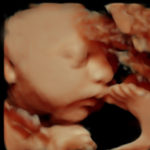 33w HD 05-02-2017_1-Edit