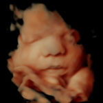 4D ultrasound