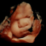 38w 6d_7