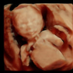 4D Sprouts 3D 4D HD Ultrasound Sarasota Florida-26-Edit