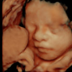 4D Sprouts 3D 4D HD Ultrasound Sarasota Florida-29