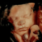 4D Sprouts 3D 4D HD Ultrasound Sarasota Florida-3