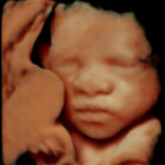 4D Sprouts 3D 4D HD Ultrasound Sarasota Florida-30