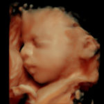 4D Sprouts 3D 4D HD Ultrasound Sarasota Florida-31