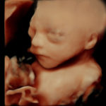4D Sprouts 3D 4D HD Ultrasound Sarasota Florida-33-Edit