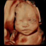 4D Sprouts 3D 4D HD Ultrasound Sarasota Florida-37
