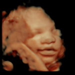 4D Sprouts 3D 4D HD Ultrasound Sarasota Florida-38