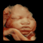 4D Sprouts 3D 4D HD Ultrasound Sarasota Florida-39