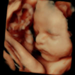 4D Sprouts 3D 4D HD Ultrasound Sarasota Florida-41