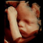 4D Sprouts 3D 4D HD Ultrasound Sarasota Florida-44