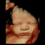 4D Sprouts 3D 4D HD Ultrasound Sarasota Florida-49