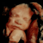 4D Sprouts 3D 4D HD Ultrasound Sarasota Florida-5