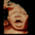 4D Sprouts 3D 4D HD Ultrasound Sarasota Florida-50