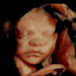 4D Sprouts 3D 4D HD Ultrasound Sarasota Florida-6