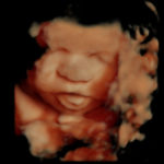 4D Sprouts 3D 4D HD Ultrasounds Sarasota Florida-12