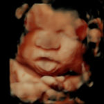 4D Sprouts 3D 4D HD Ultrasounds Sarasota Florida-13