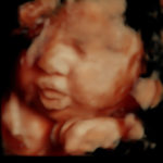 4D Sprouts 3D 4D HD Ultrasounds Sarasota Florida-14