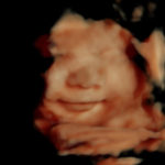 4D Sprouts 3D 4D HD Ultrasounds Sarasota Florida-16