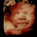 4D Sprouts 3D 4D HD Ultrasounds Sarasota Florida-18