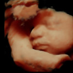 4D Sprouts 3D 4D HD Ultrasounds Sarasota Florida-20