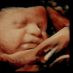 4D Sprouts 3D 4D HD Ultrasounds Sarasota Florida-22