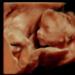 4D Sprouts 3D 4D HD Ultrasounds Sarasota Florida-23