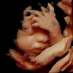 4D Sprouts 3D 4D HD Ultrasounds Sarasota Florida-28