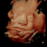 4D Sprouts 3D 4D HD Ultrasounds Sarasota Florida-29