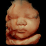 4D Sprouts 3D 4D HD Ultrasounds Sarasota Florida-3