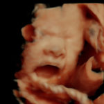 4D Sprouts 3D 4D HD Ultrasounds Sarasota Florida-30