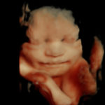 4D Sprouts 3D 4D HD Ultrasounds Sarasota Florida-32