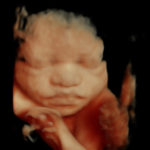 4D Sprouts 3D 4D HD Ultrasounds Sarasota Florida-33