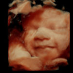 4D Sprouts 3D 4D HD Ultrasounds Sarasota Florida-34