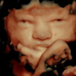 4D Sprouts 3D 4D HD Ultrasounds Sarasota Florida-35