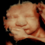 4D Sprouts 3D 4D HD Ultrasounds Sarasota Florida-36
