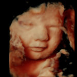 4D Sprouts 3D 4D HD Ultrasounds Sarasota Florida-38