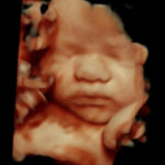 4D Sprouts 3D 4D HD Ultrasounds Sarasota Florida-4