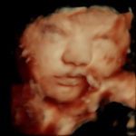 4D Sprouts 3D 4D HD Ultrasounds Sarasota Florida-43