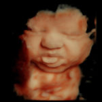 4D Sprouts 3D 4D HD Ultrasounds Sarasota Florida-44