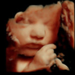4D Sprouts 3D 4D HD Ultrasounds Sarasota Florida-45