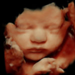 4D Sprouts 3D 4D HD Ultrasounds Sarasota Florida-46