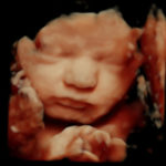 4D Sprouts 3D 4D HD Ultrasounds Sarasota Florida-48