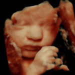 4D Sprouts 3D 4D HD Ultrasounds Sarasota Florida-49